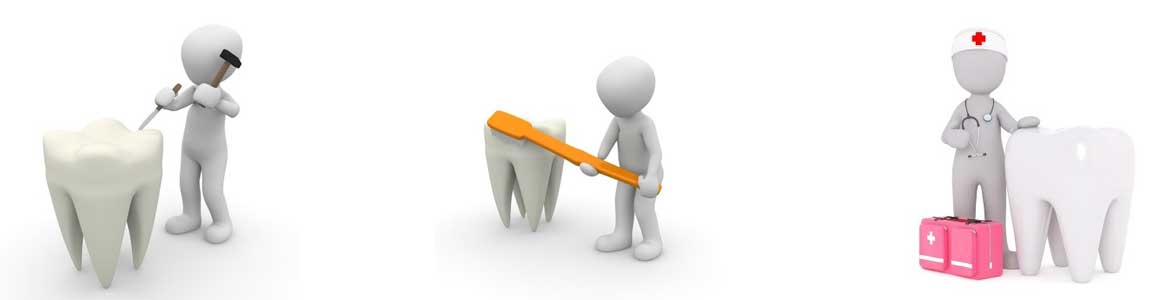 Axa Versicherung 3 Top Tarife Der Zahnzusatzversicherung Dbv Axa